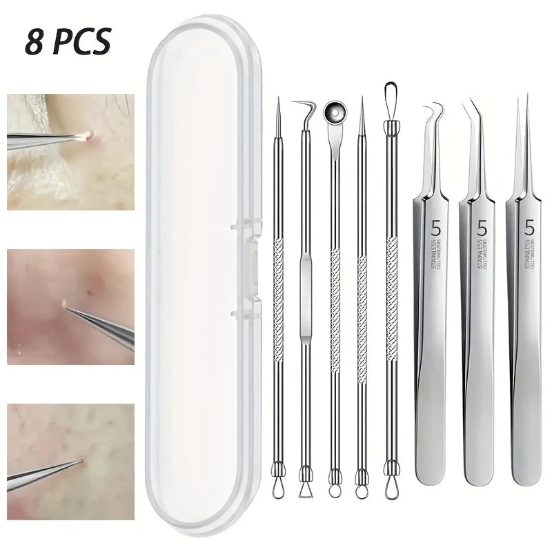 8-Piece Blackhead Remover Kit – Stainless Steel Blemish & Acne Extraction Tools – Professional Pimple Popper Set for All Skin